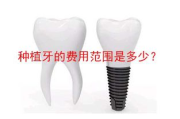种植牙多少钱,价格构成与影响因素全面解析