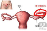 输卵管检查多少钱,全面解析输卵管检查费用与选择指南