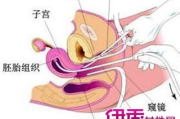 清宫要多少钱,手术费用详解与影响因素分析