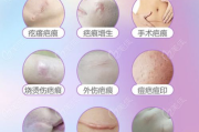 疤痕修复多少钱,费用构成与性价比分析