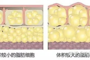 全身抽脂多少钱,价格构成与影响因素全面解析
