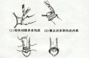 包皮环切术费用解析：价格构成与影响因素详解