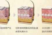 水光针多少钱,价格构成与影响因素全解析
