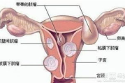 子宫肌瘤手术费用全解析：价格构成、影响因素与经济考量