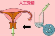 人工授精费用全解析：影响因素与预算指南