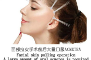 拉皮手术多少钱？全面解析面部提升术价格构成与影响因素