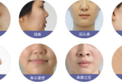 整容要多少钱：全面解析整形手术价格构成与影响因素
