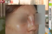 隆鼻手术多少钱,全面解析价格影响因素与性价比选择