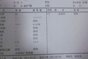 白带常规检查多少钱,价格因素与性价比分析
