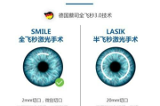 激光治疗近视多少钱,全面解析价格因素与选择指南